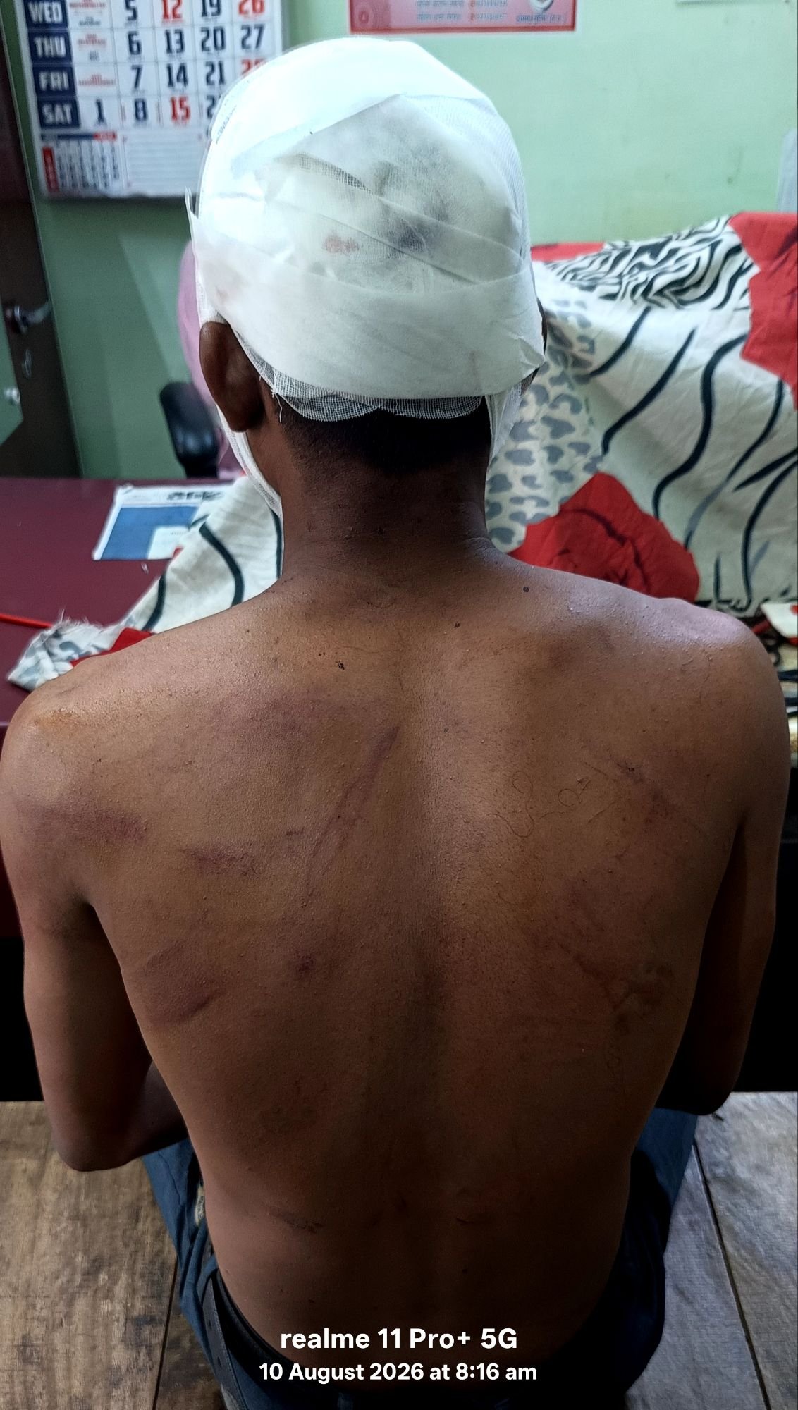 चूड़ा, बेल्ट और डंडे से मारपीट का आरोप; मंदिर परिसर में सुरक्षा व्यवस्था बढ़ाने की उठी मांग 7 img 20260810 1007125565736268643089862